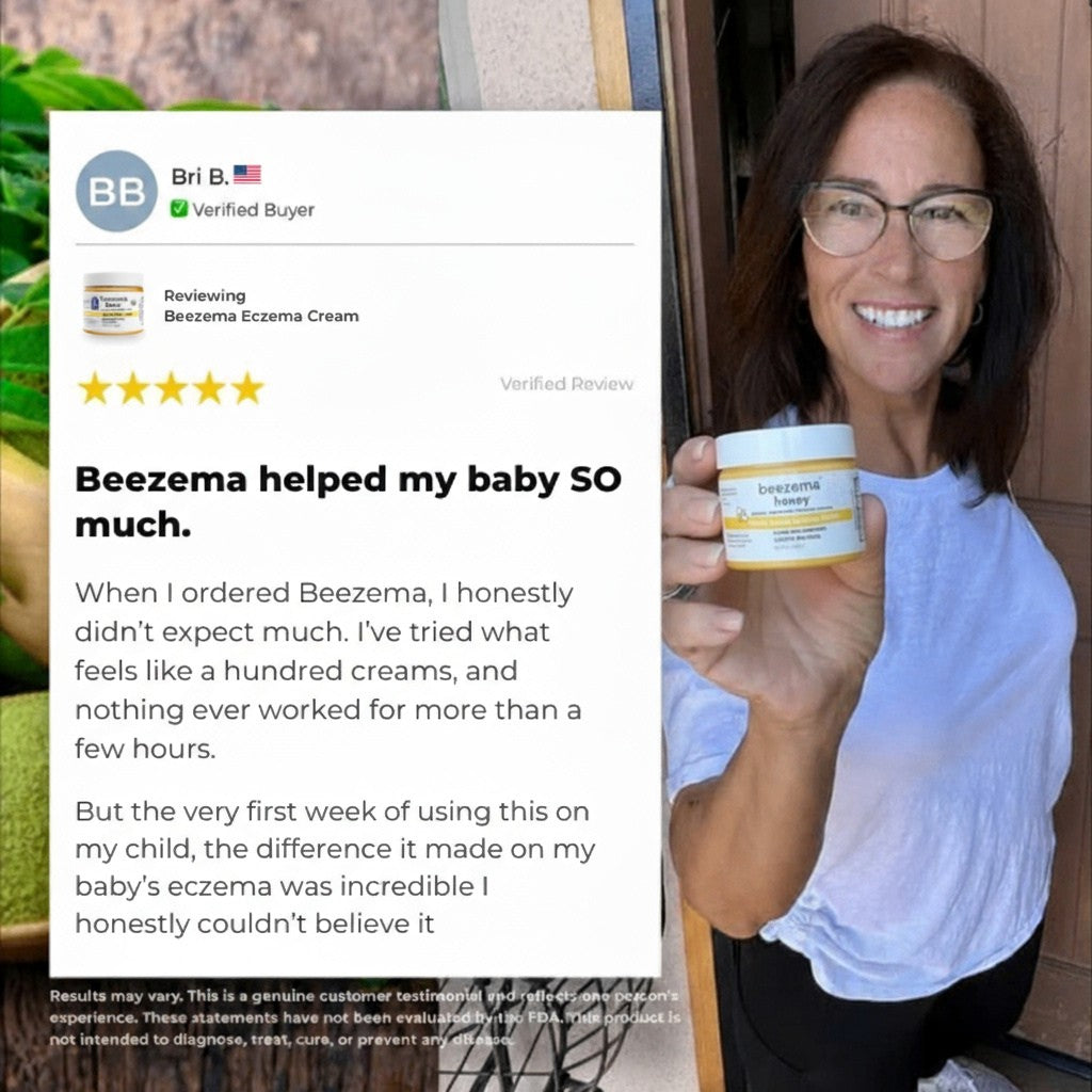 Finally Stop Your Baby's Endless Scratching Naturally with Beezema