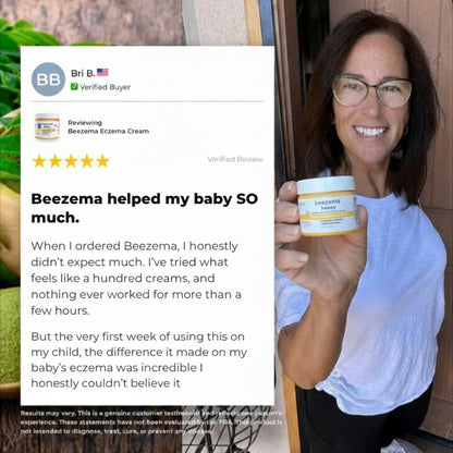 Finally Stop Your Baby's Endless Scratching Naturally with Beezema