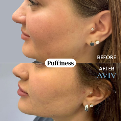 Organic Lymphatic Drainage Drops (Copia)