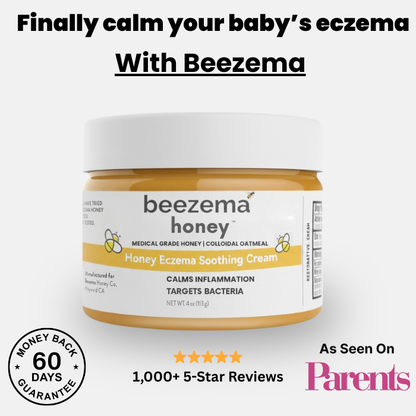 Finally Stop Your Baby's Endless Scratching Naturally with Beezema