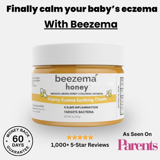 Finally Stop Your Baby's Endless Scratching Naturally with Beezema