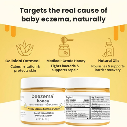 Finally Stop Your Baby's Endless Scratching Naturally with Beezema