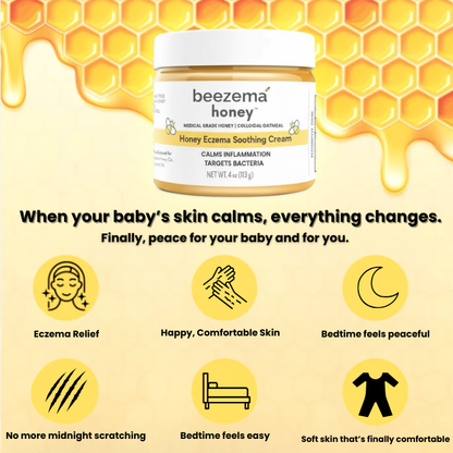 Finally Stop Your Baby's Endless Scratching Naturally with Beezema