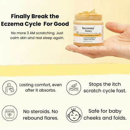 Finally Stop Your Baby's Endless Scratching Naturally with Beezema