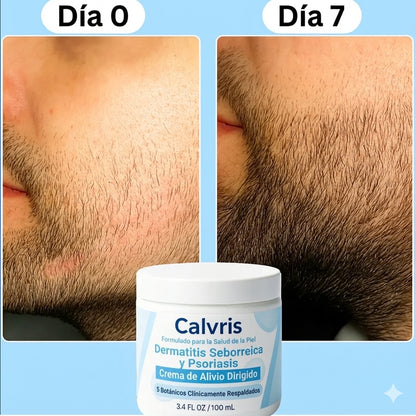 Beard Recovery Cream