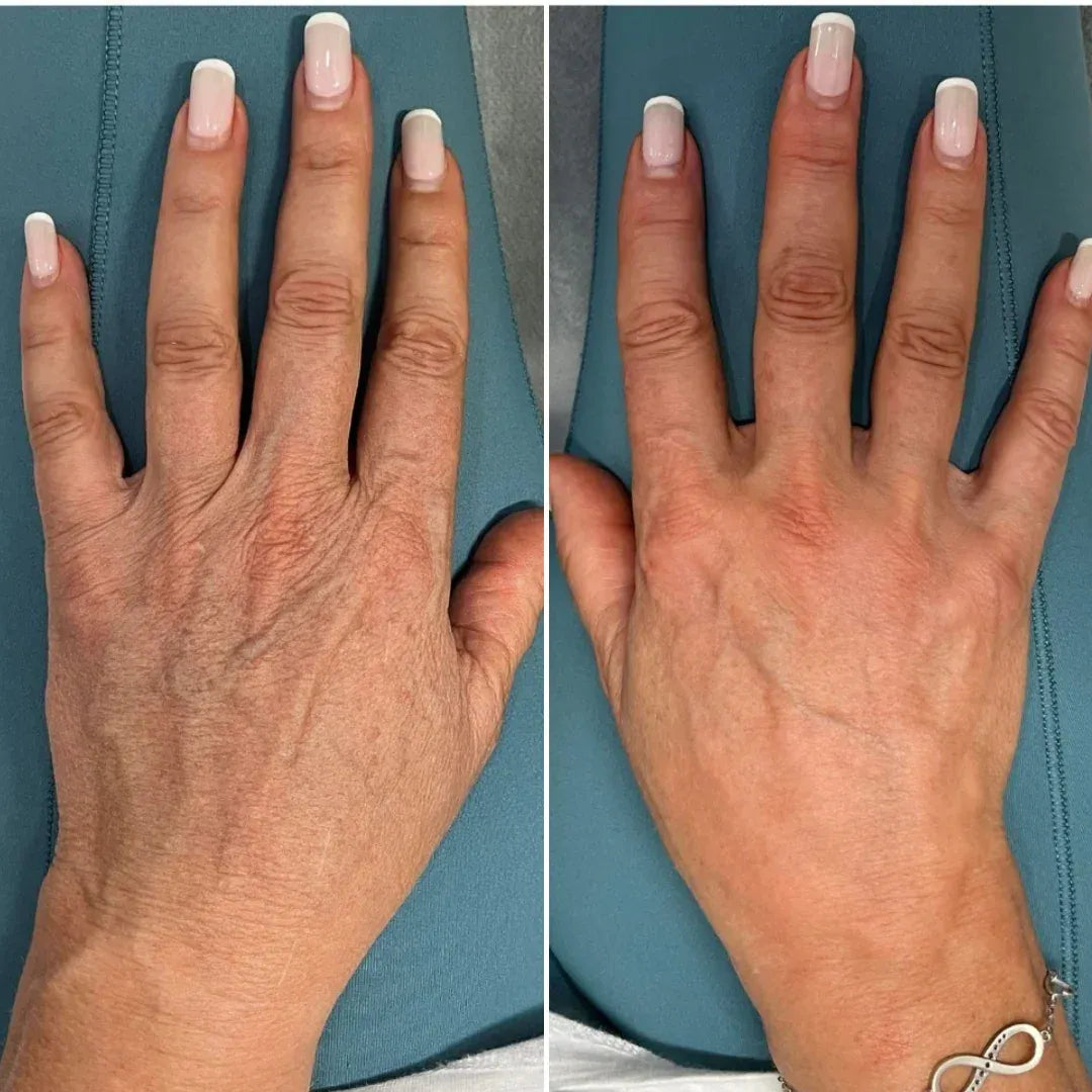 YouthLift Retinol Hand Cream